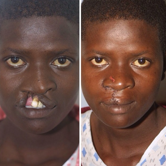 22-year-old.png 22-year-old.png