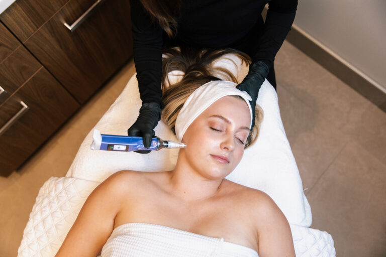 Patient receiving Skinpen microneedling at BOYD Patient receiving Skinpen microneedling at BOYD